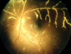 DR Hugues SEMIN - LIMOGES