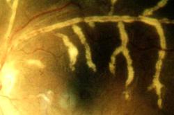 DR Hugues SEMIN - LIMOGES